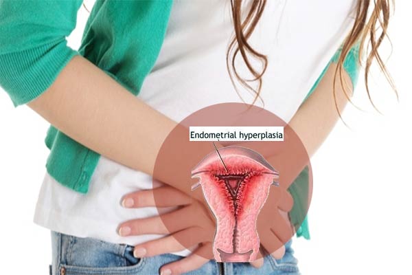 hiperplasia endometrium