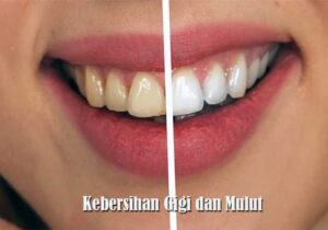 Kebersihan Gigi dan Mulut