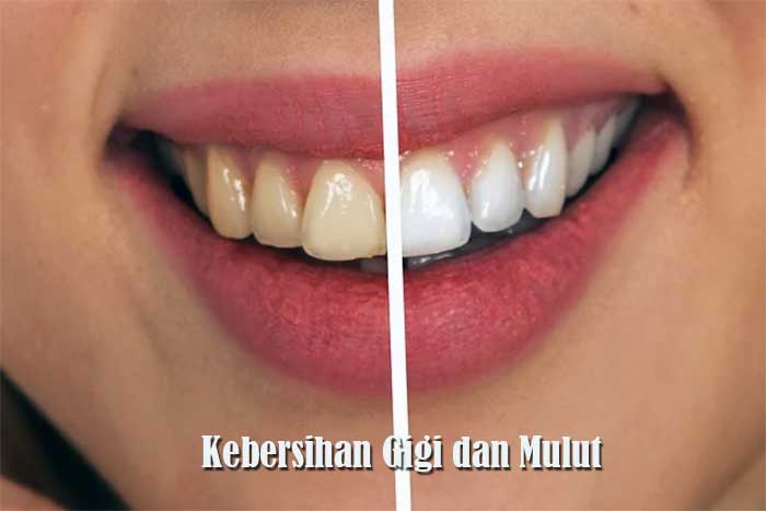 Kebersihan Gigi dan Mulut